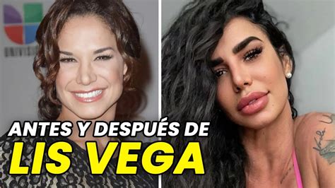 lis vega antes y después|Lis Vega a lo largo de su carrera en 16 fotografías: el antes y。